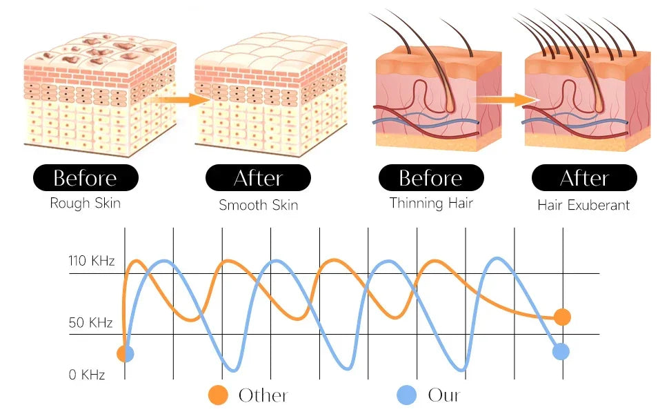 Technical diagram showing the high-frequency wand's efficacy on skin and hair, with before-and-after results for smooth skin, reduced roughness, and hair growth for thinning hair, operating at an optimal frequency of 110 KHz