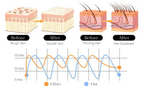 Technical diagram showing the high-frequency wand's efficacy on skin and hair, with before-and-after results for smooth skin, reduced roughness, and hair growth for thinning hair, operating at an optimal frequency of 110 KHz